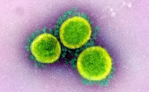 Johnson & Johnson is launching a major push to develop a vaccine that can neutralize the new coronavirus. Image by National Institute of Allergy and Infectious Diseases / National Institutes of Health. United States, 2020.